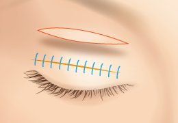 https://img.miyanlife.com/mnt/timg/180618/135I95421-0.jpg
