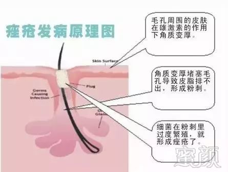 案例图片