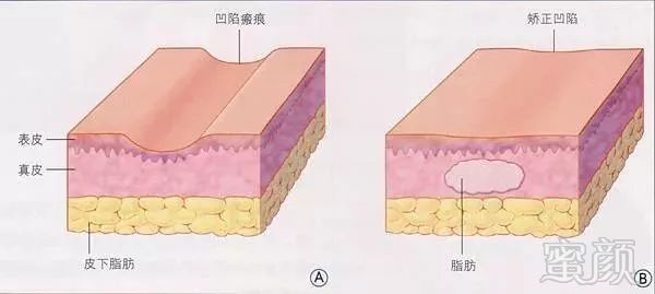 案例图片