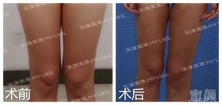 https://img.miyanlife.com/mnt/timg/180618/144T3H15-3.jpg