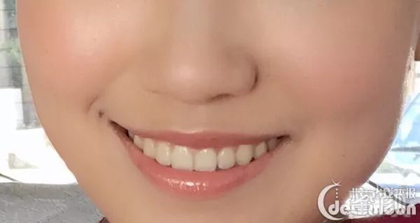 https://img.miyanlife.com/mnt/timg/180618/1504246128-5.jpg