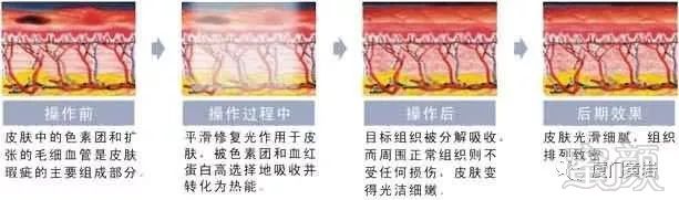 案例图片