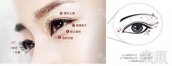 https://img.miyanlife.com/mnt/timg/180619/112622HF-0.jpg