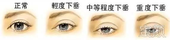 https://img.miyanlife.com/mnt/timg/180619/1126243L7-5.jpg