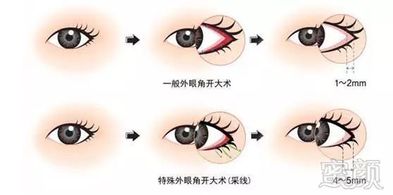 https://img.miyanlife.com/mnt/timg/180619/112624A32-4.jpg