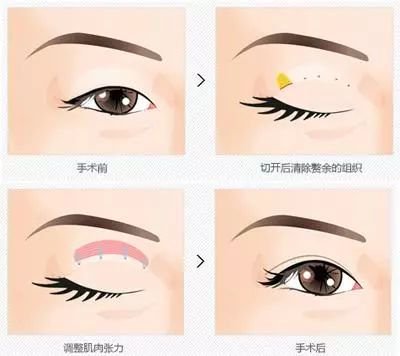 https://img.miyanlife.com/mnt/timg/180619/112625O56-6.jpg