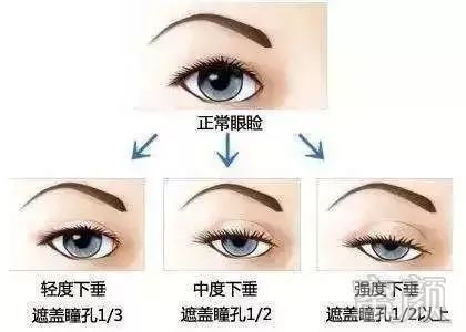 https://img.miyanlife.com/mnt/timg/180619/112J415J-6.jpg