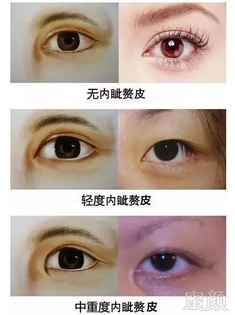 https://img.miyanlife.com/mnt/timg/180619/112J53609-7.jpg