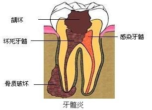 案例图片