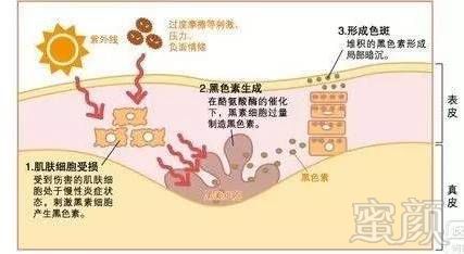 https://img.miyanlife.com/mnt/timg/180620/114441E49-9.jpg