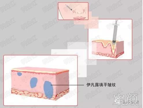 案例图片