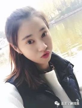 https://img.miyanlife.com/mnt/timg/180620/120P22101-1.jpg