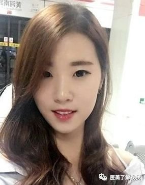 https://img.miyanlife.com/mnt/timg/180620/120P2JV-0.jpg