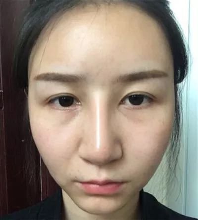 https://img.miyanlife.com/mnt/timg/180621/1100001221-0.jpg