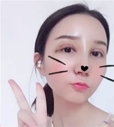 https://img.miyanlife.com/mnt/timg/180621/1100003H4-1.jpg