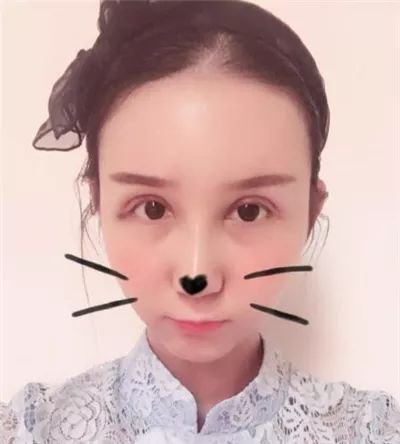 https://img.miyanlife.com/mnt/timg/180621/1100013151-2.jpg