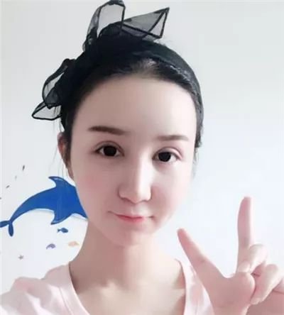 https://img.miyanlife.com/mnt/timg/180621/1100013612-5.jpg