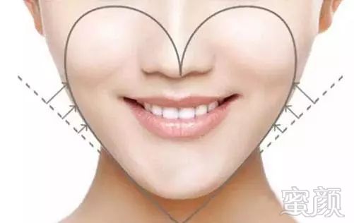 https://img.miyanlife.com/mnt/timg/180621/1103494109-0.jpg