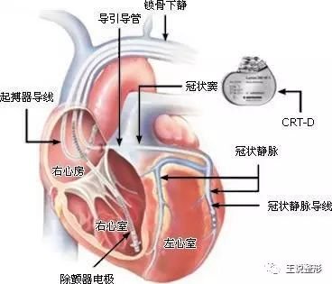 案例图片