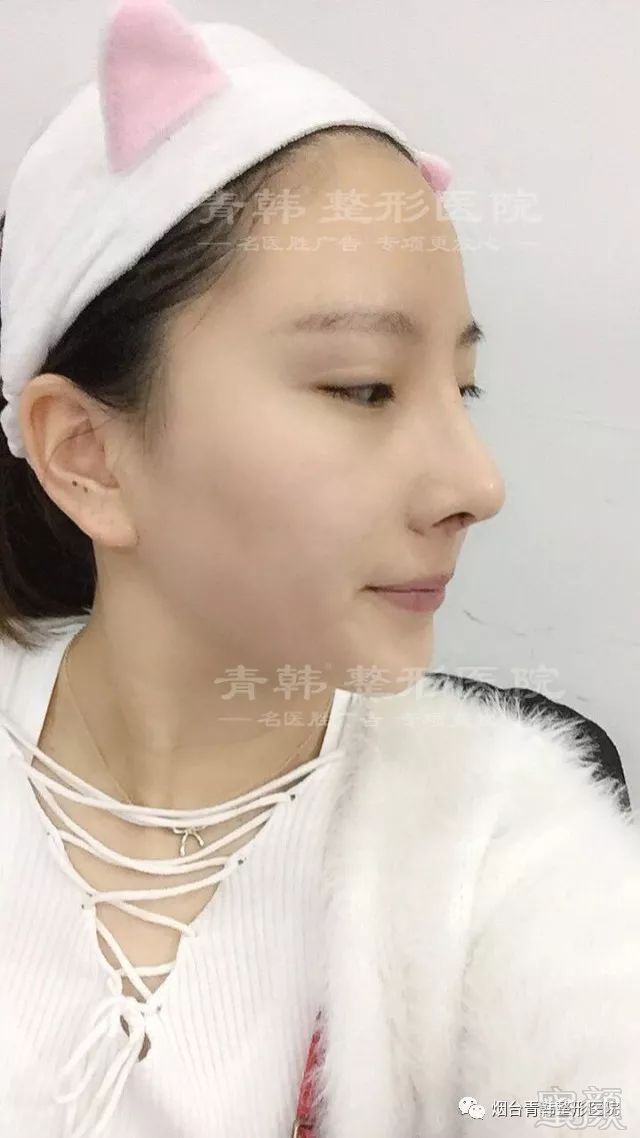 https://img.miyanlife.com/mnt/timg/180621/1213543006-7.jpg