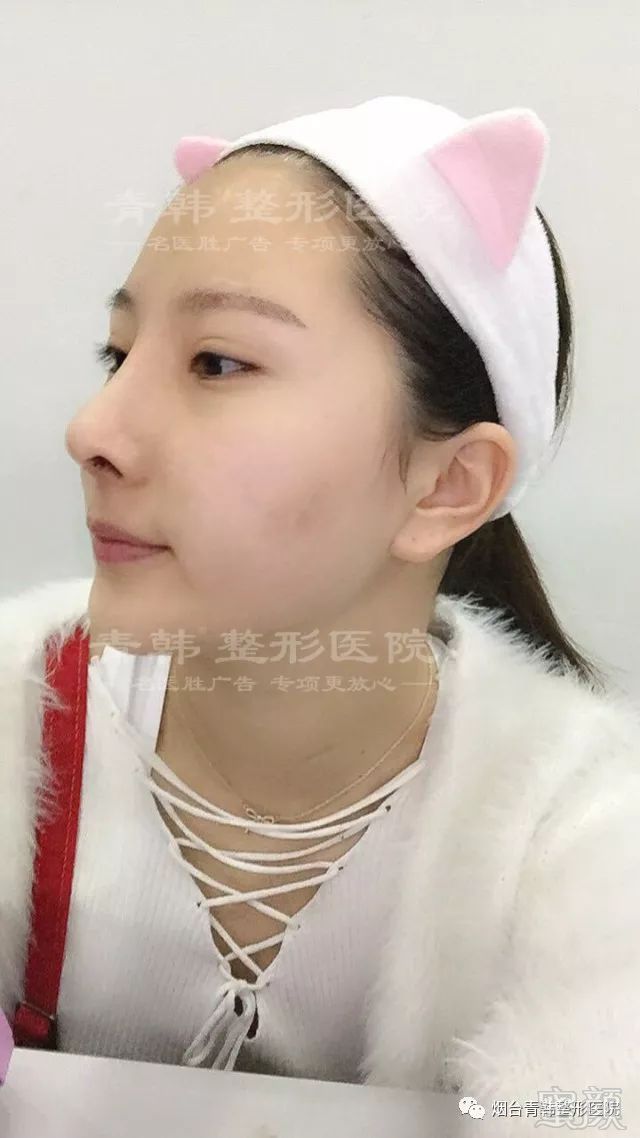 https://img.miyanlife.com/mnt/timg/180621/1213552537-8.jpg