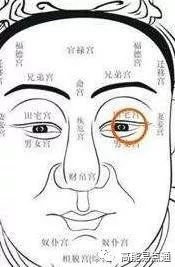 案例图片