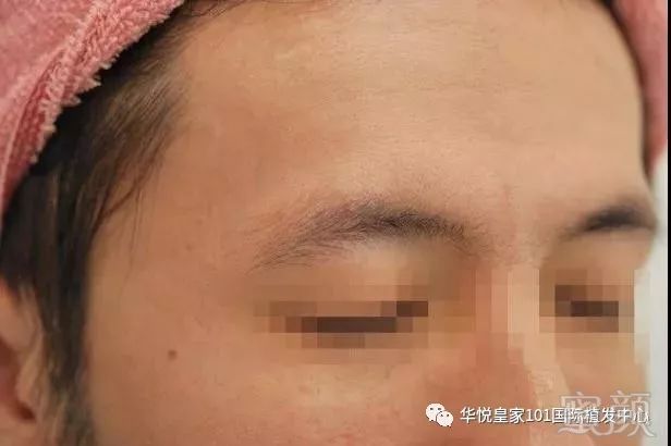 https://img.miyanlife.com/mnt/timg/180622/1111162150-2.jpg