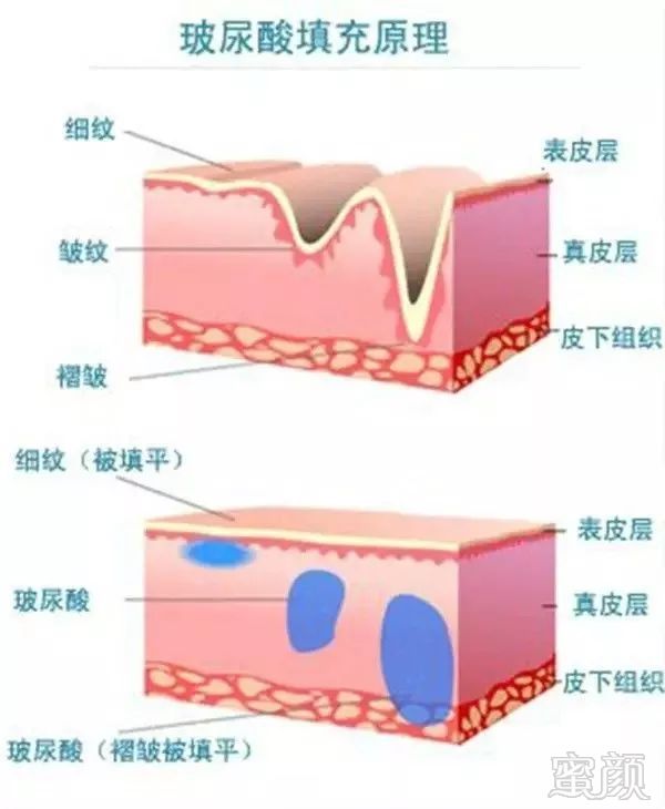 https://img.miyanlife.com/mnt/timg/180622/1114521158-4.jpg