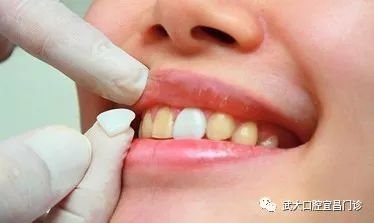 https://img.miyanlife.com/mnt/timg/180622/112Q01I4-3.jpg