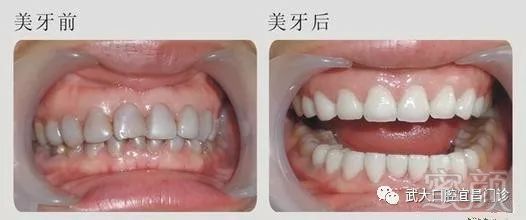 https://img.miyanlife.com/mnt/timg/180622/112Q15601-4.jpg