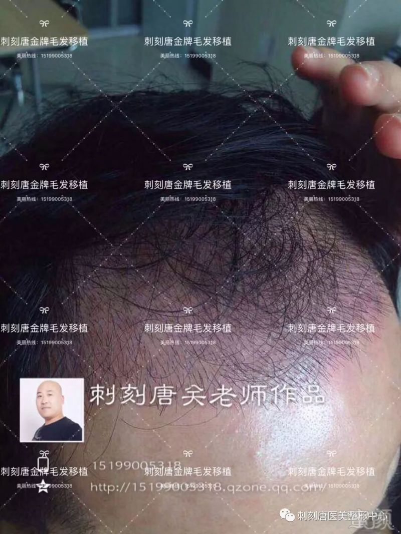 案例图片