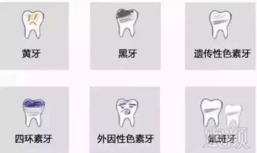 https://img.miyanlife.com/mnt/timg/180622/113F943Z-4.jpg