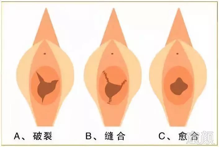 案例图片