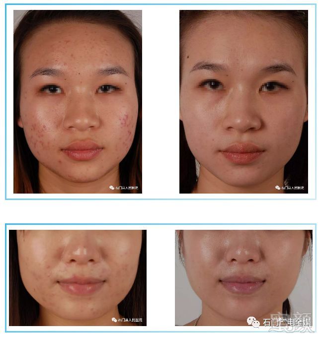https://img.miyanlife.com/mnt/timg/180623/1300245325-9.jpg