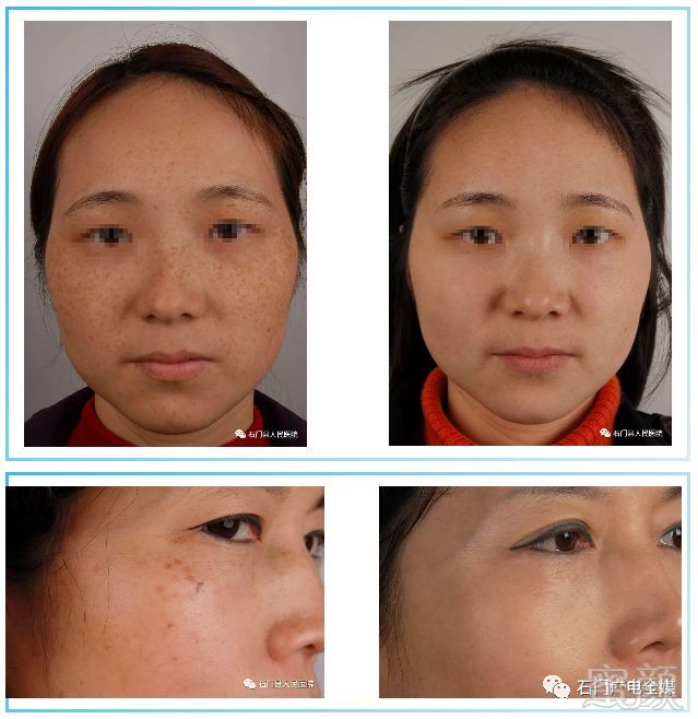 https://img.miyanlife.com/mnt/timg/180623/130025E11-10.jpg