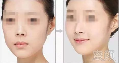 https://img.miyanlife.com/mnt/timg/180623/13221U103-6.jpg