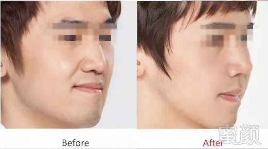 https://img.miyanlife.com/mnt/timg/180623/13221a943-9.jpg