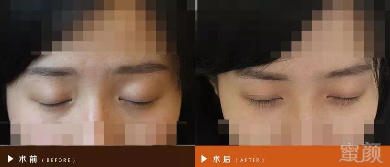 https://img.miyanlife.com/mnt/timg/180623/1431263N1-4.jpg