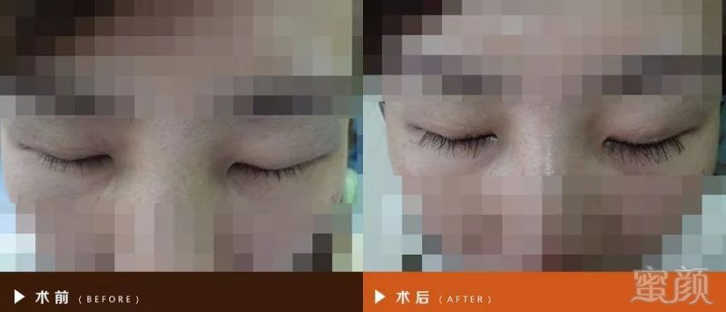 https://img.miyanlife.com/mnt/timg/180623/14312C4c-3.jpg