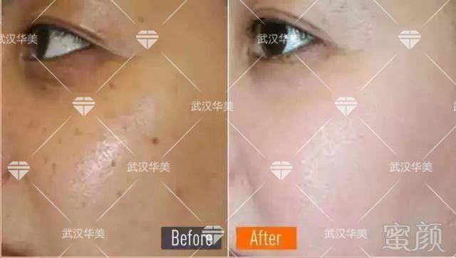 https://img.miyanlife.com/mnt/timg/180624/11094140F-4.jpg