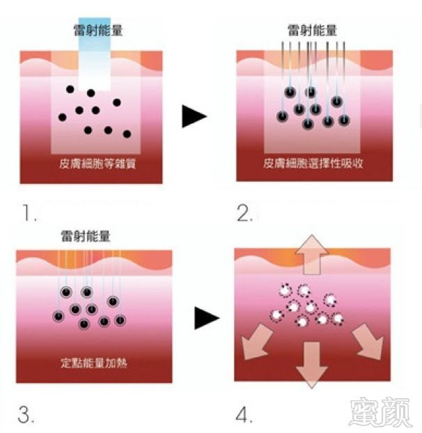 https://img.miyanlife.com/mnt/timg/180624/1139391O0-2.jpg