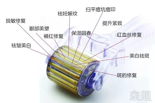 案例图片