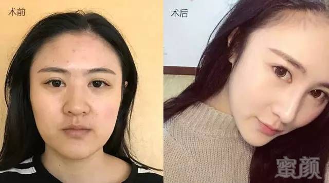https://img.miyanlife.com/mnt/timg/180625/10500M133-6.jpg