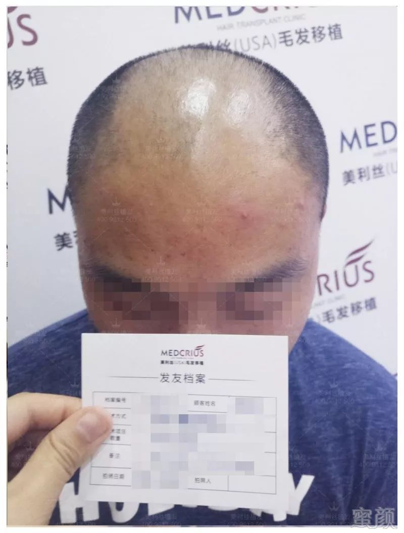 https://img.miyanlife.com/mnt/timg/180625/11044H911-0.jpg