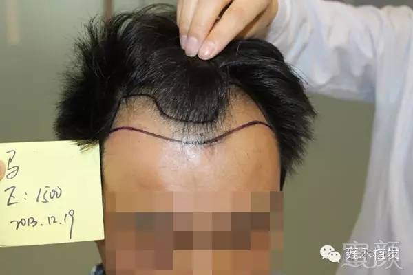 https://img.miyanlife.com/mnt/timg/180625/1141364222-3.jpg