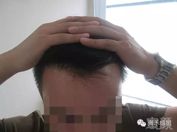 https://img.miyanlife.com/mnt/timg/180625/1141391A5-8.jpg