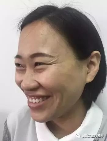 https://img.miyanlife.com/mnt/timg/180625/1229251Q7-0.jpg