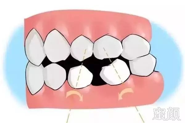 https://img.miyanlife.com/mnt/timg/180626/11133L0M-11.jpg