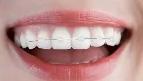 https://img.miyanlife.com/mnt/timg/180626/11133W429-14.jpg
