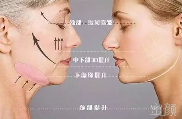 https://img.miyanlife.com/mnt/timg/180626/111A061R-6.jpg